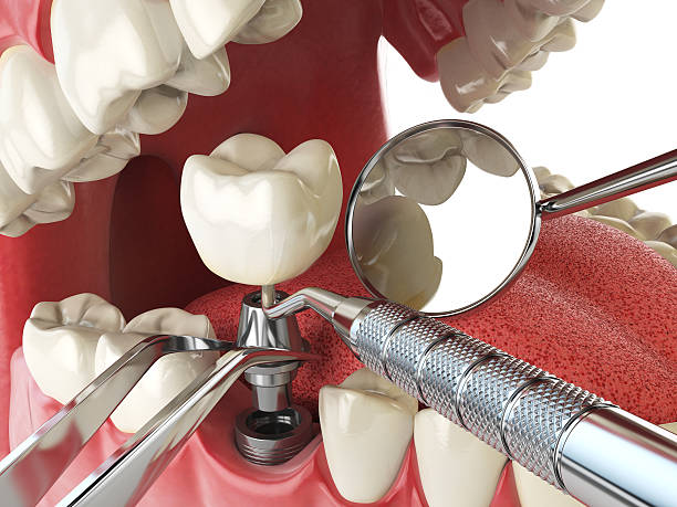 Best Urgent Care for Lost Fillings or Crowns in Penns Grove, NJ